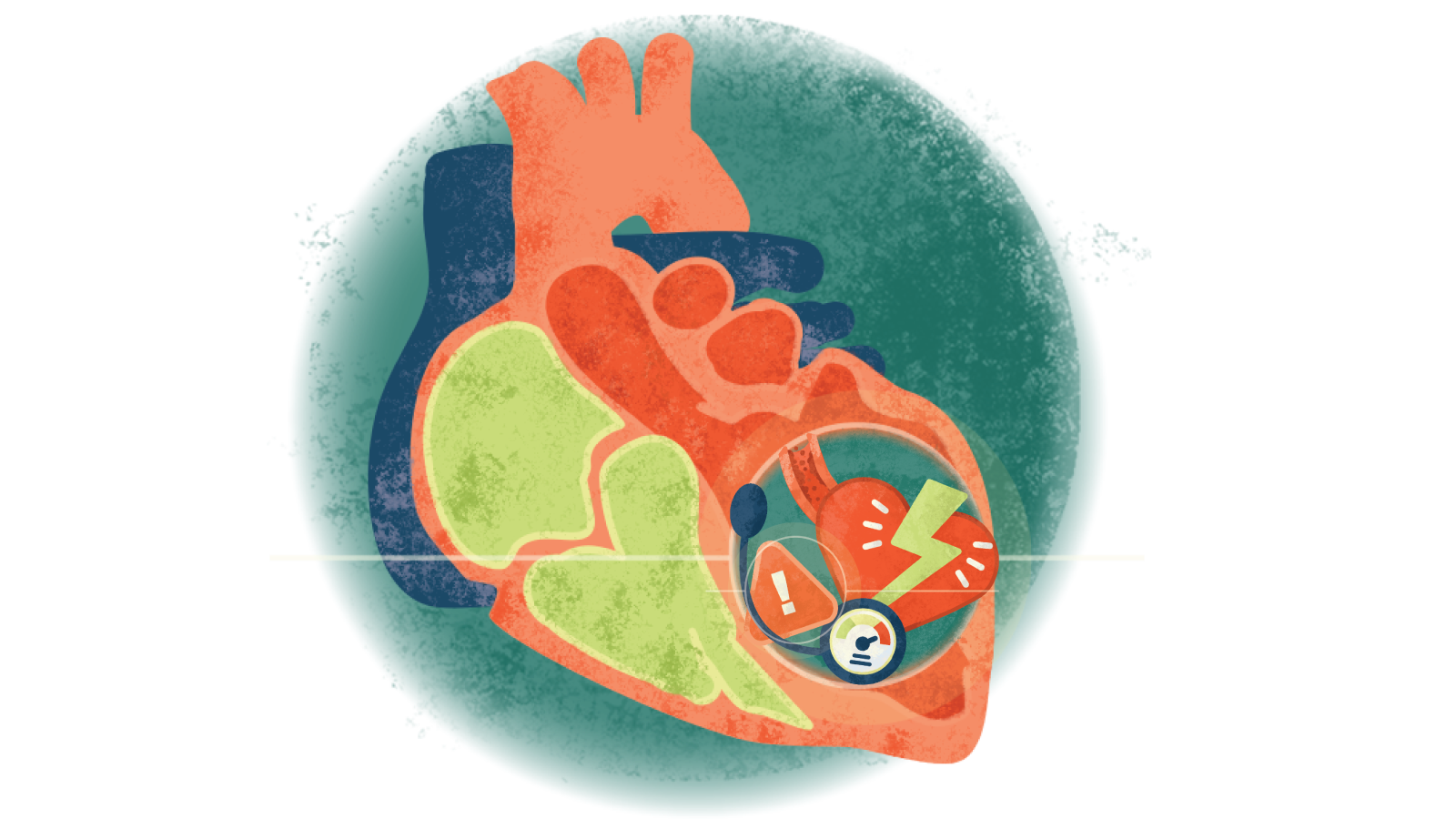 Illustration of a blood pressure pump, lightening bolt over heart & exclamation point in a triangle in a circle over a heart