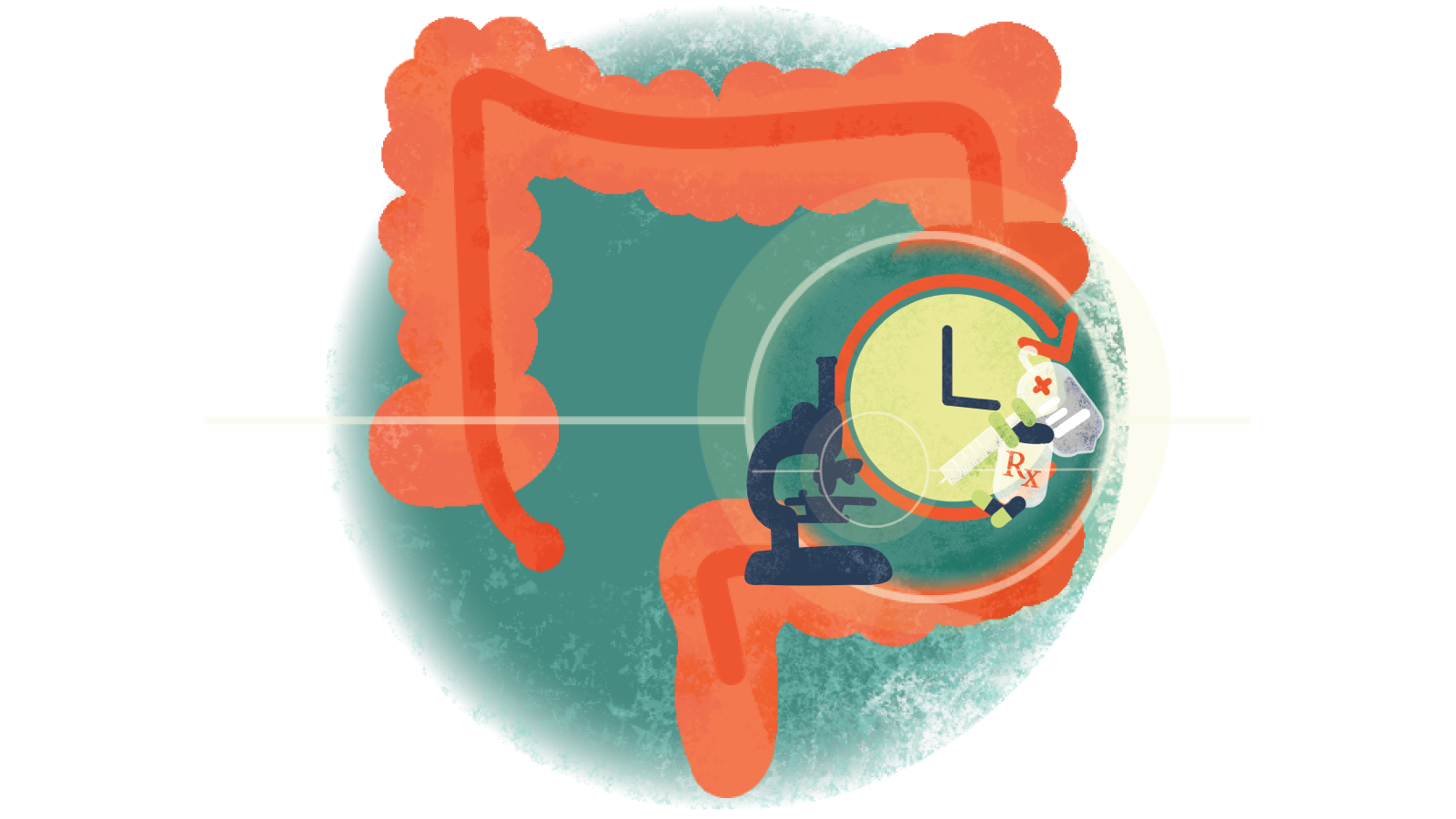 Illustration of pills, syringe, IV bag over a clock and microscope over a colon with ulcerative colitis