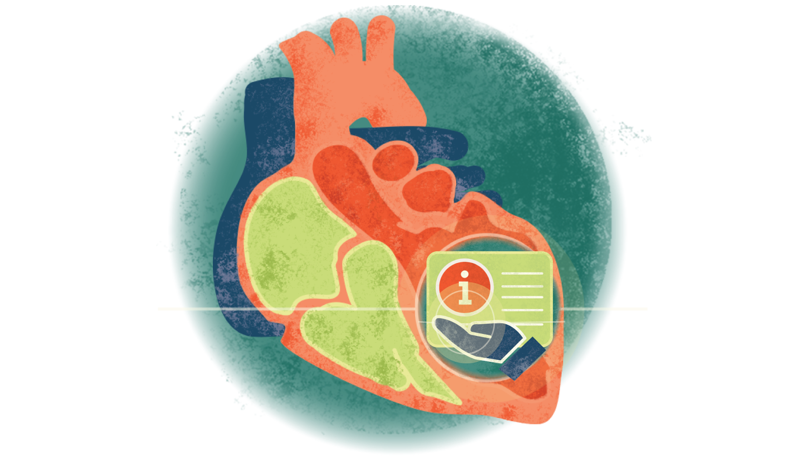 Illustration of the letter i over a hand over a heart with cardiomyopathy
