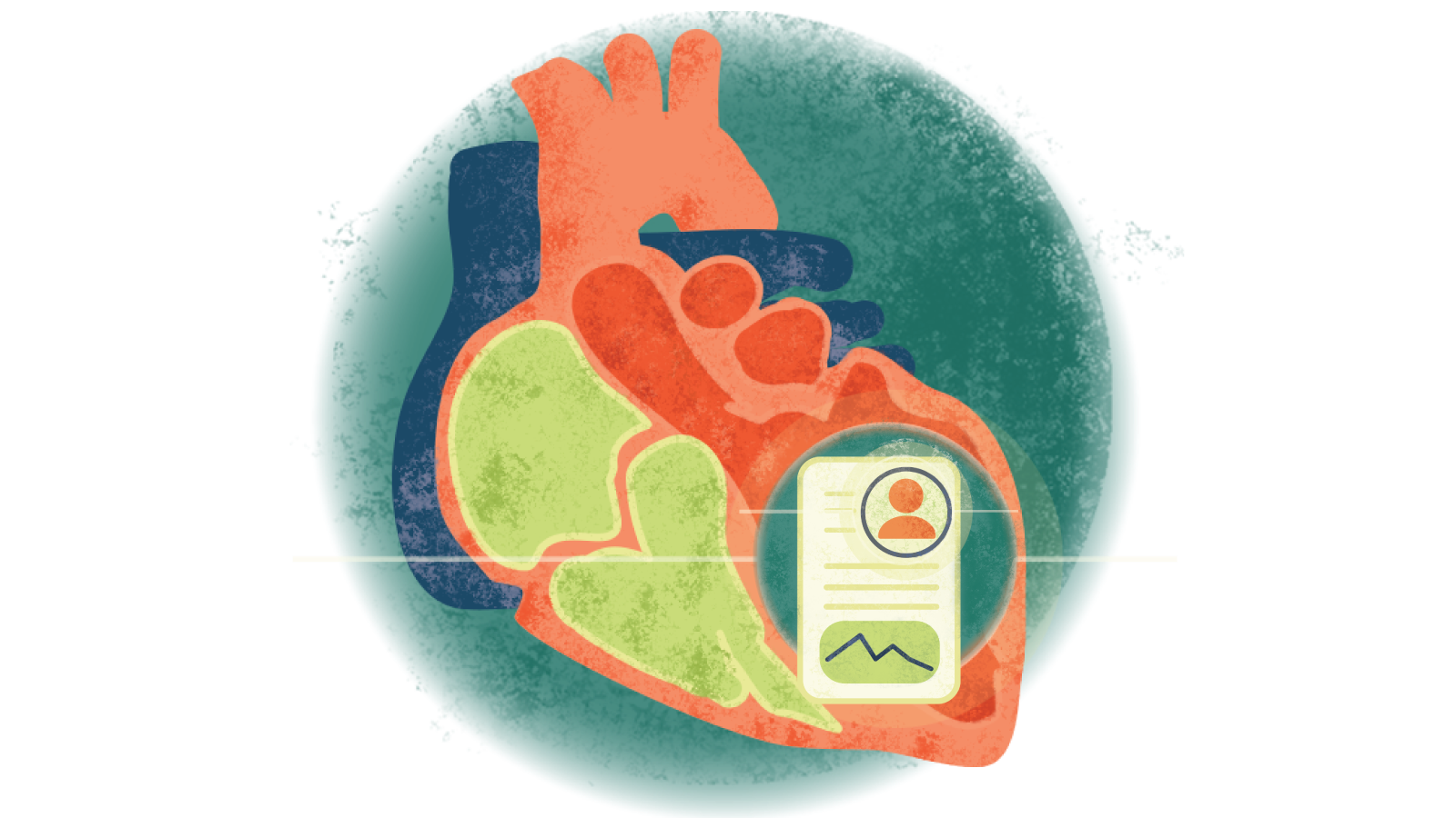 Illustration of a written case study over a heart with cardiomyopathy